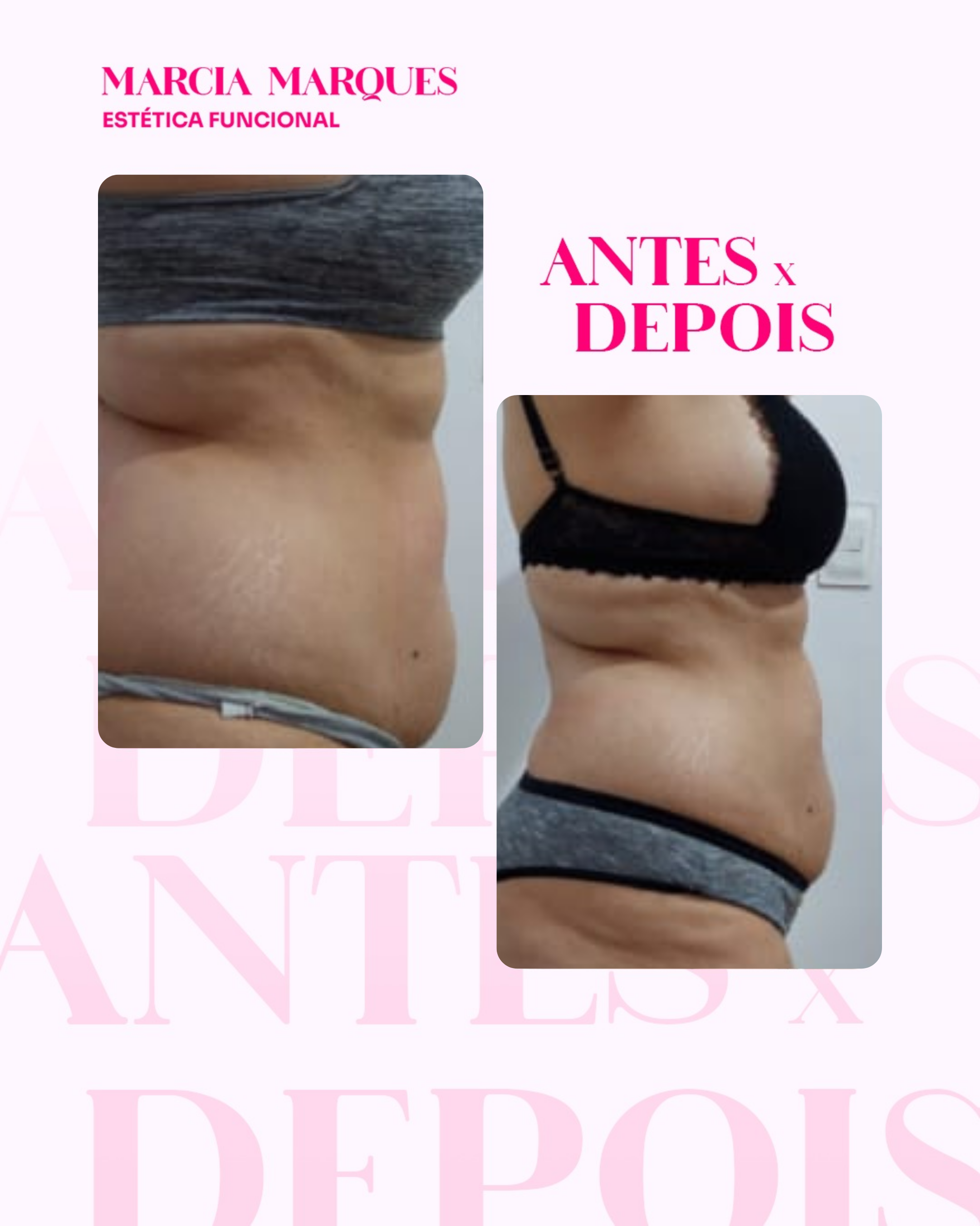 Antes e Depois 2